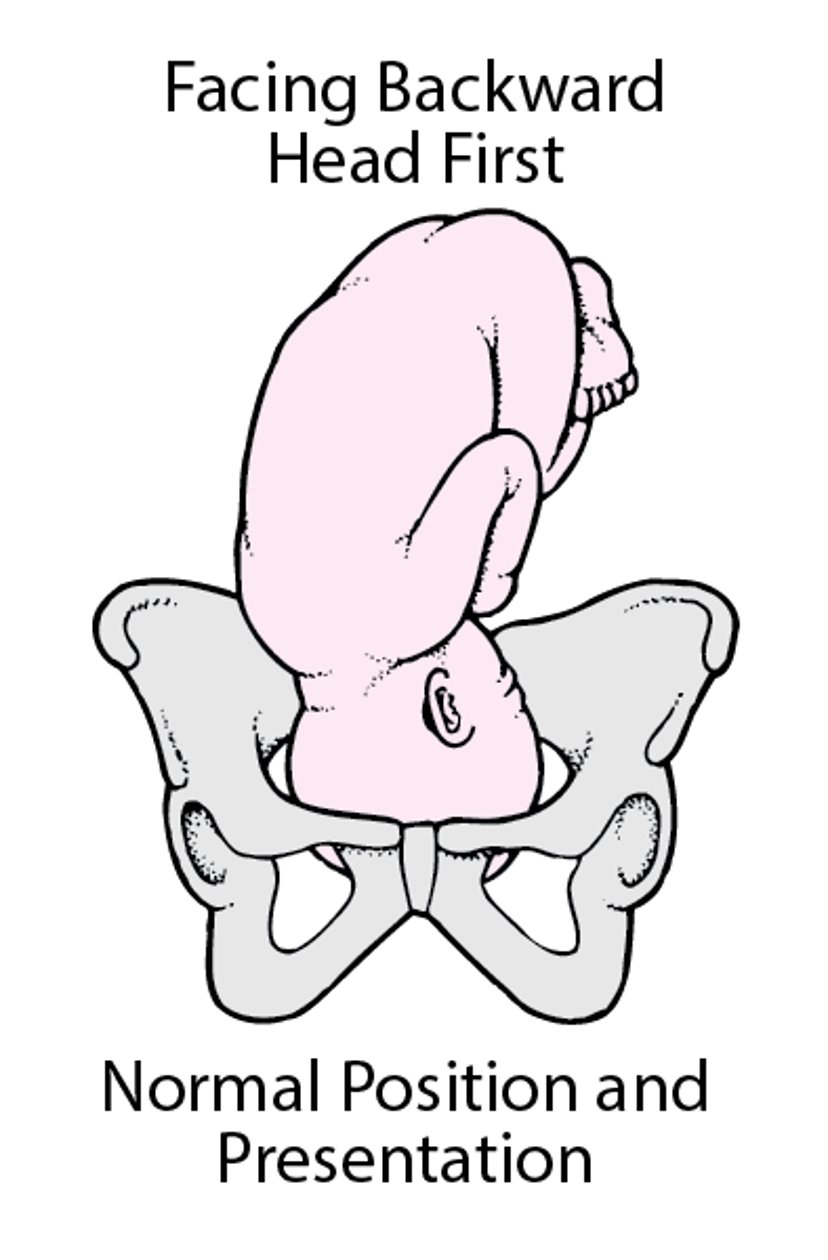 正常胎位和胎先露