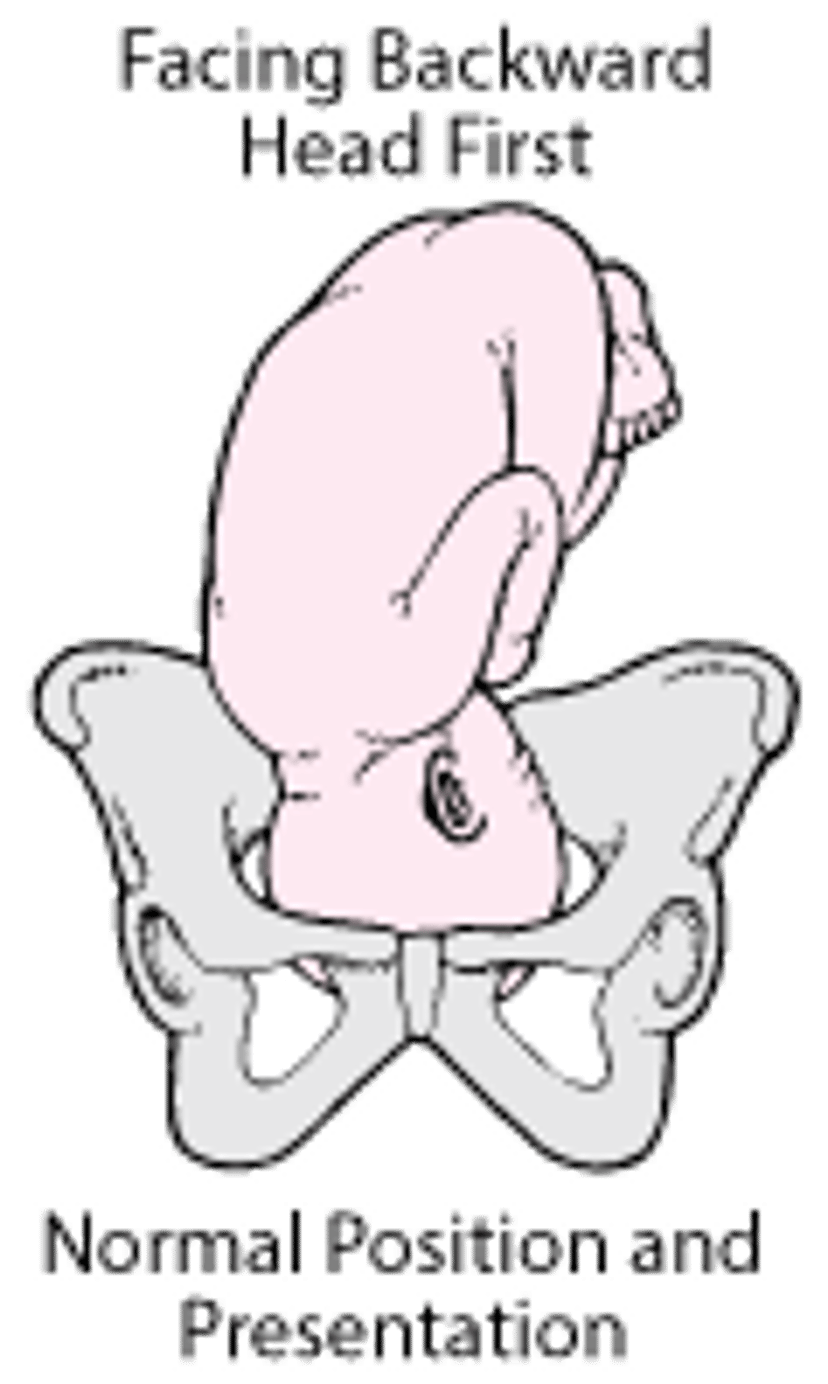正常胎位和胎先露