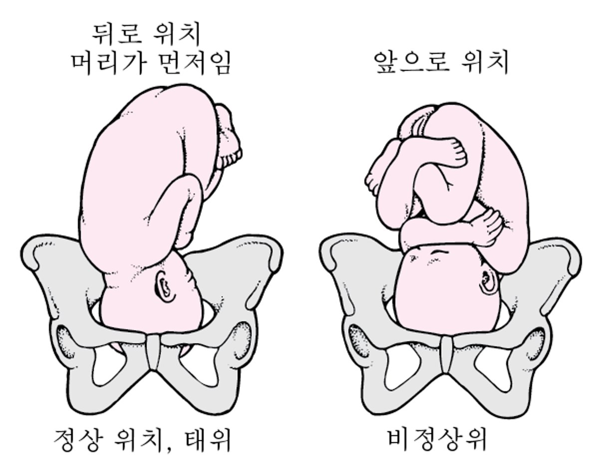 태아의 자세와 태위