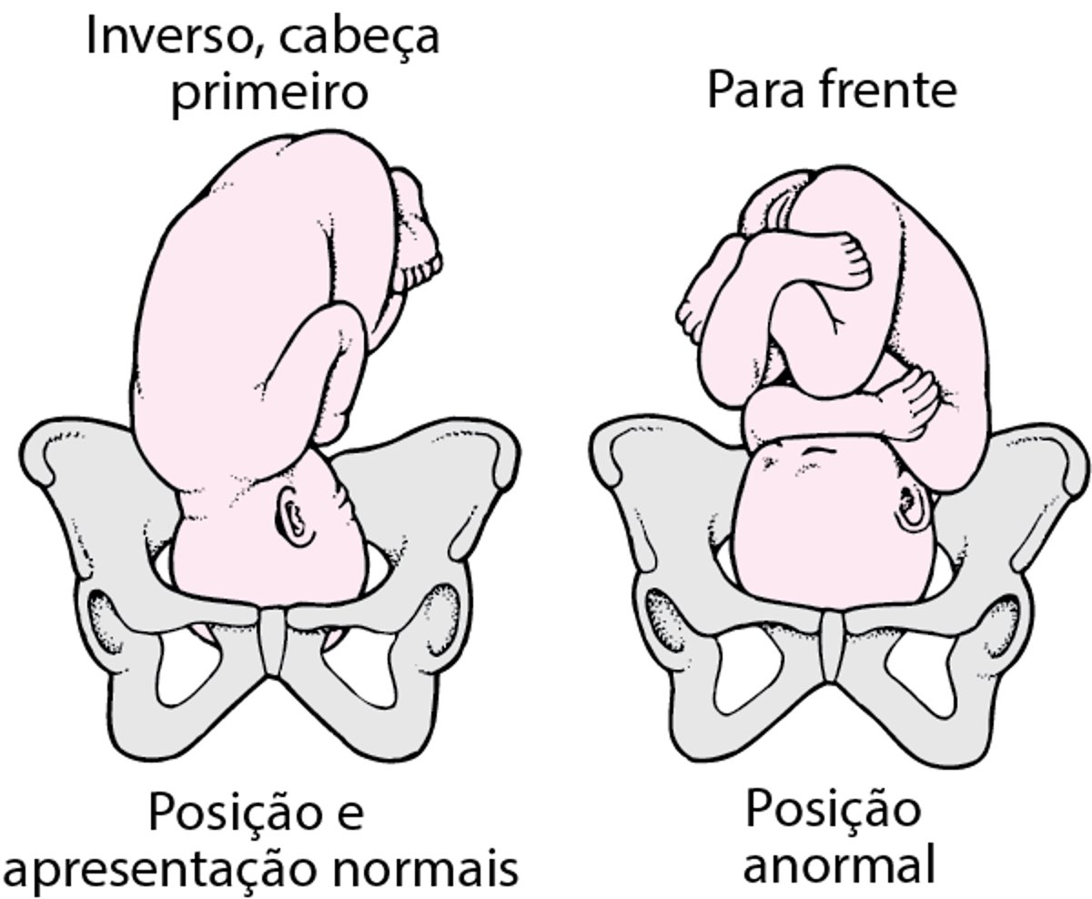 Posição e apresentação do feto