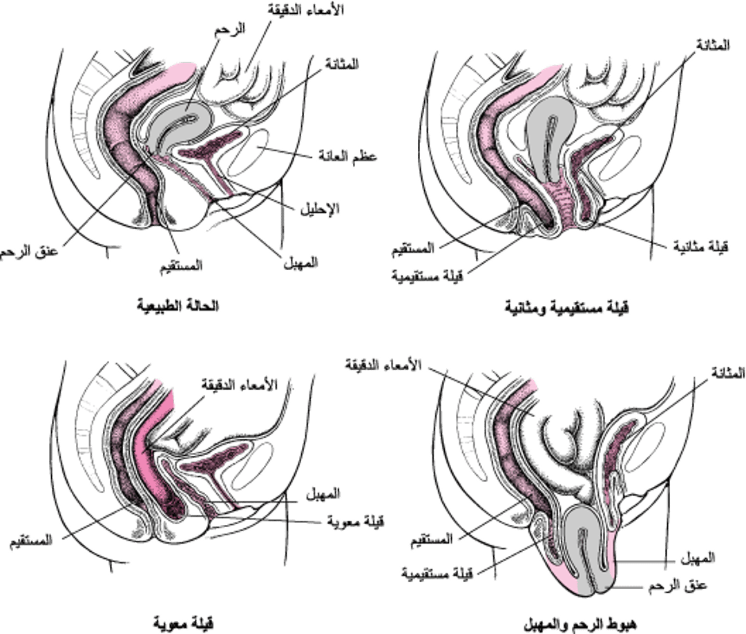 عندما يهبِطُ قاع الحوض: تدلِّي في الحَوض