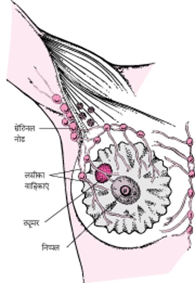 सेंटिनल लिम्फ नोड क्या है?