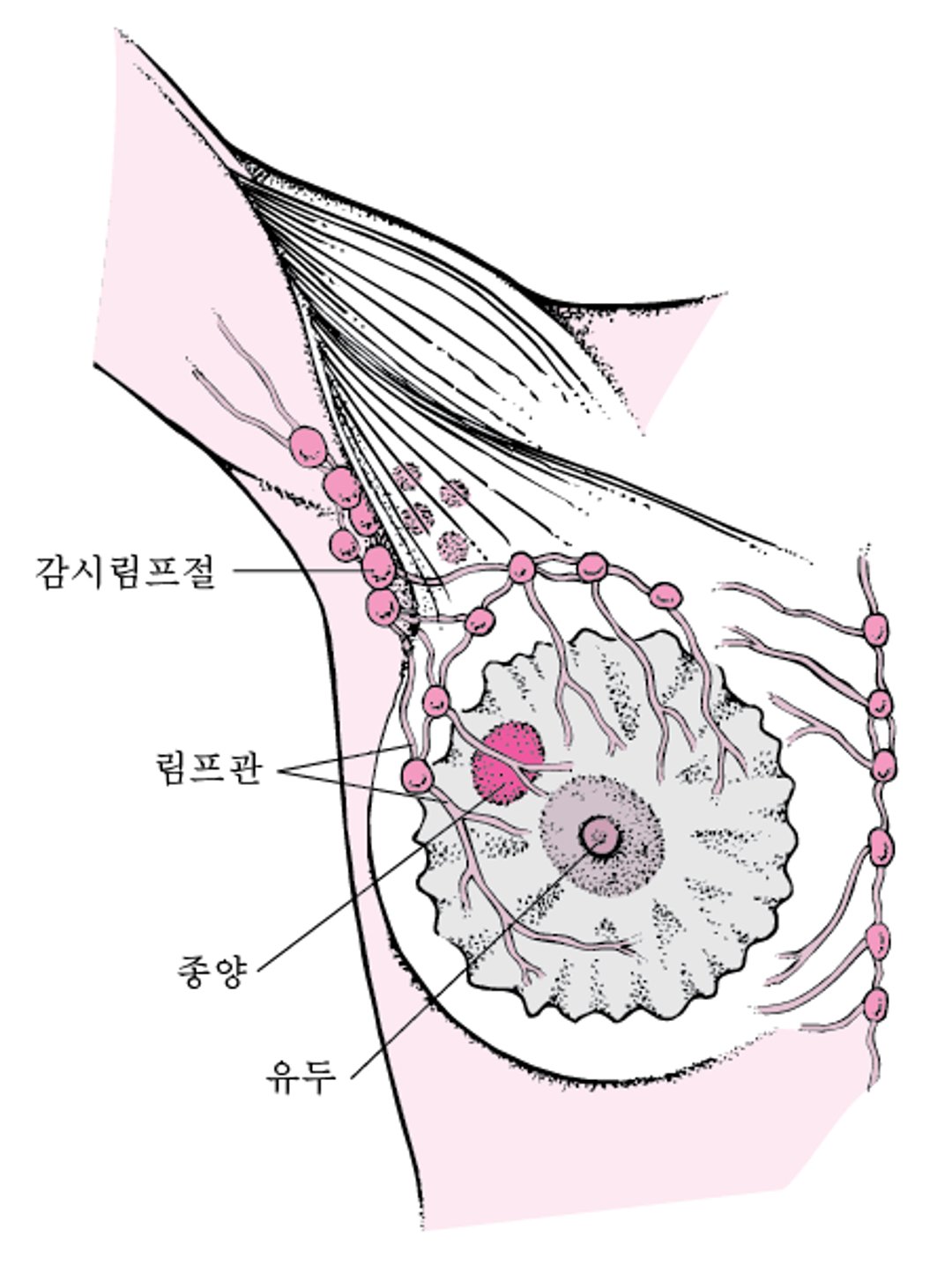감시 림프절이 무엇입니까?