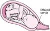 Stages of Labor
