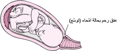 مراحل المخاض