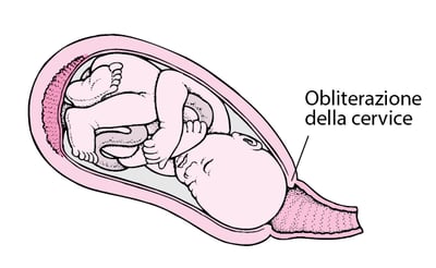 Fasi del travaglio