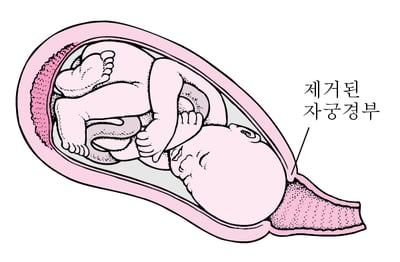 분만 단계