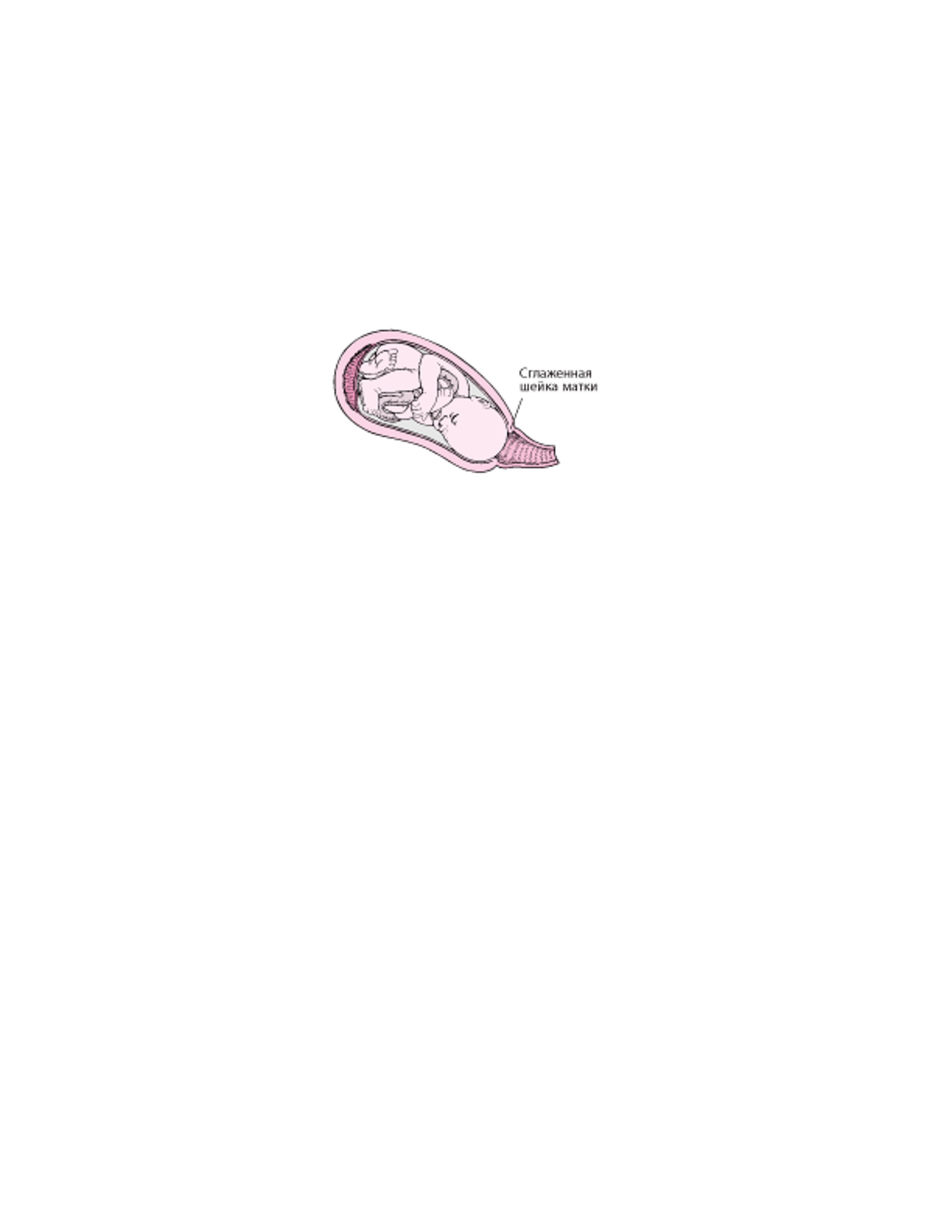 Периоды родов