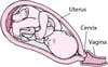Stages of Labor