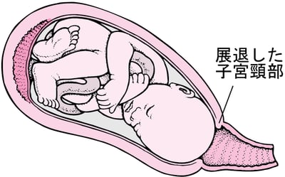 分娩の段階