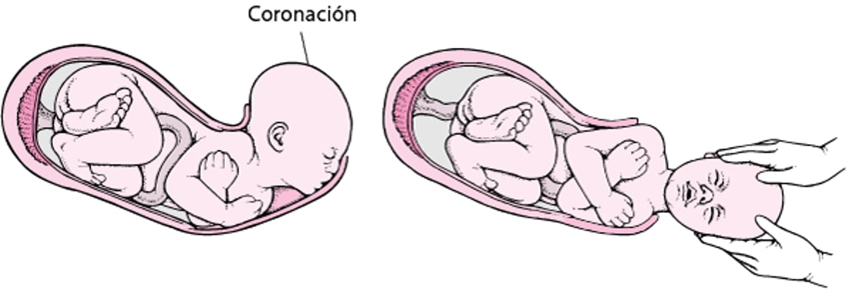 Etapas del parto