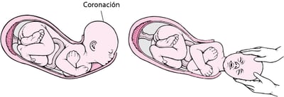 Etapas del parto