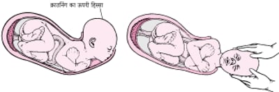 प्रसवपीड़ा के चरण