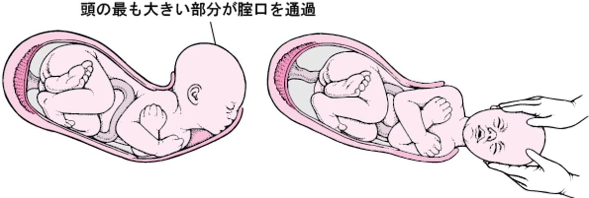 分娩の段階