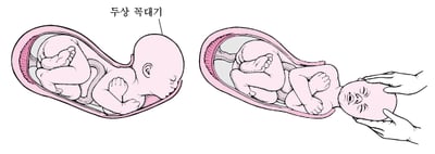 분만 단계