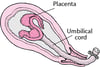 Stages of Labor
