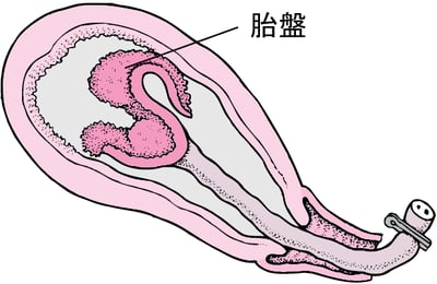 分娩の段階