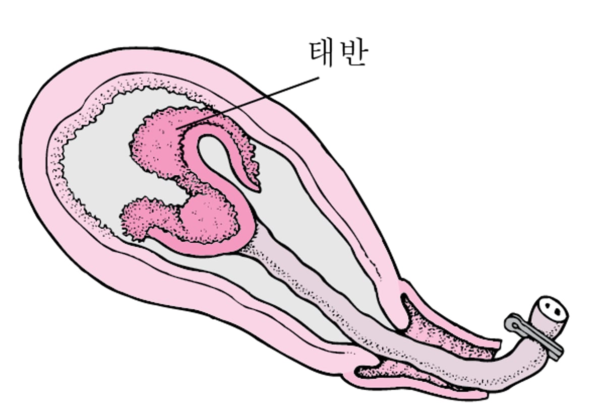 분만 단계