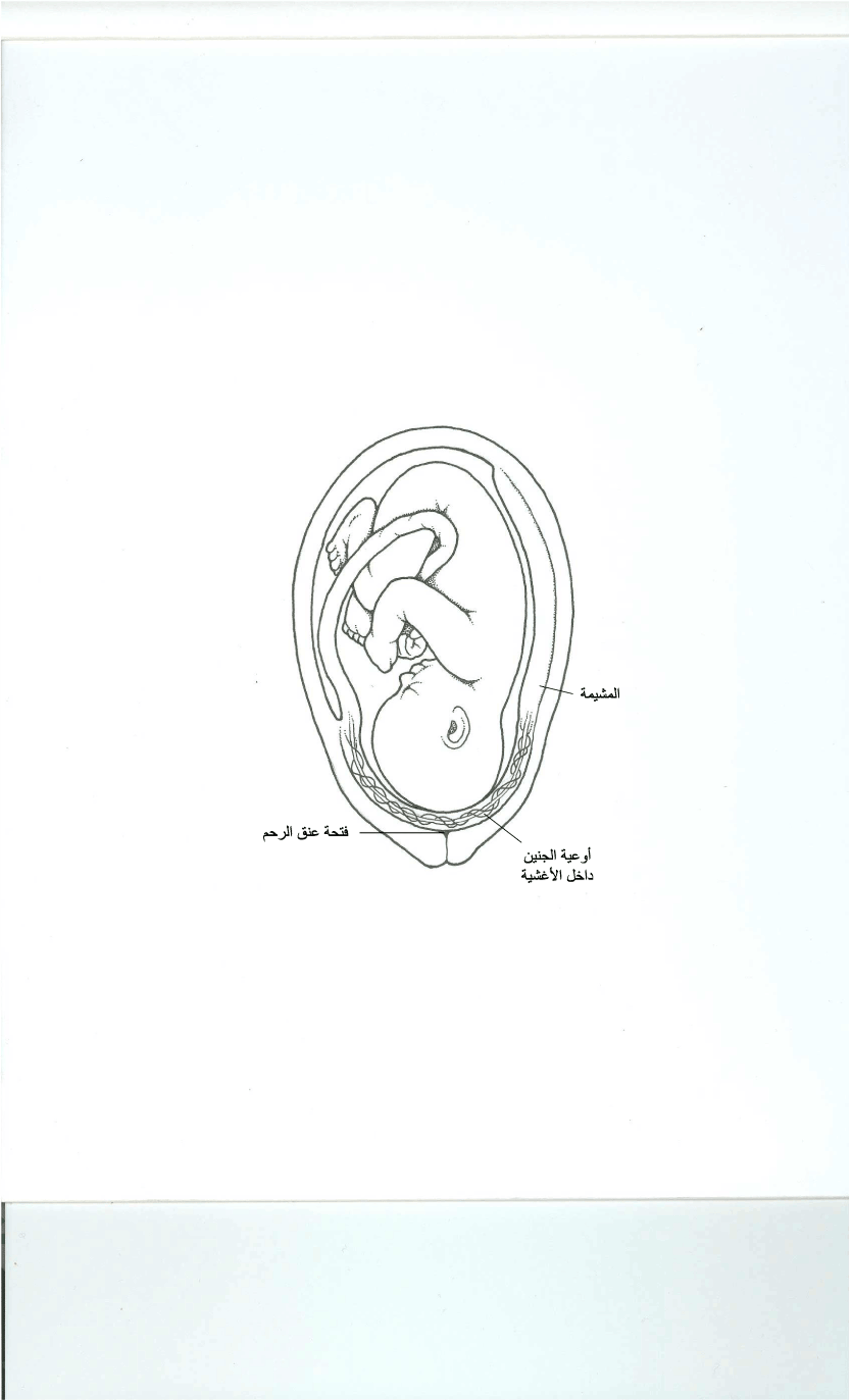 ما هي الأَوعِيَة المنزاحة؟
