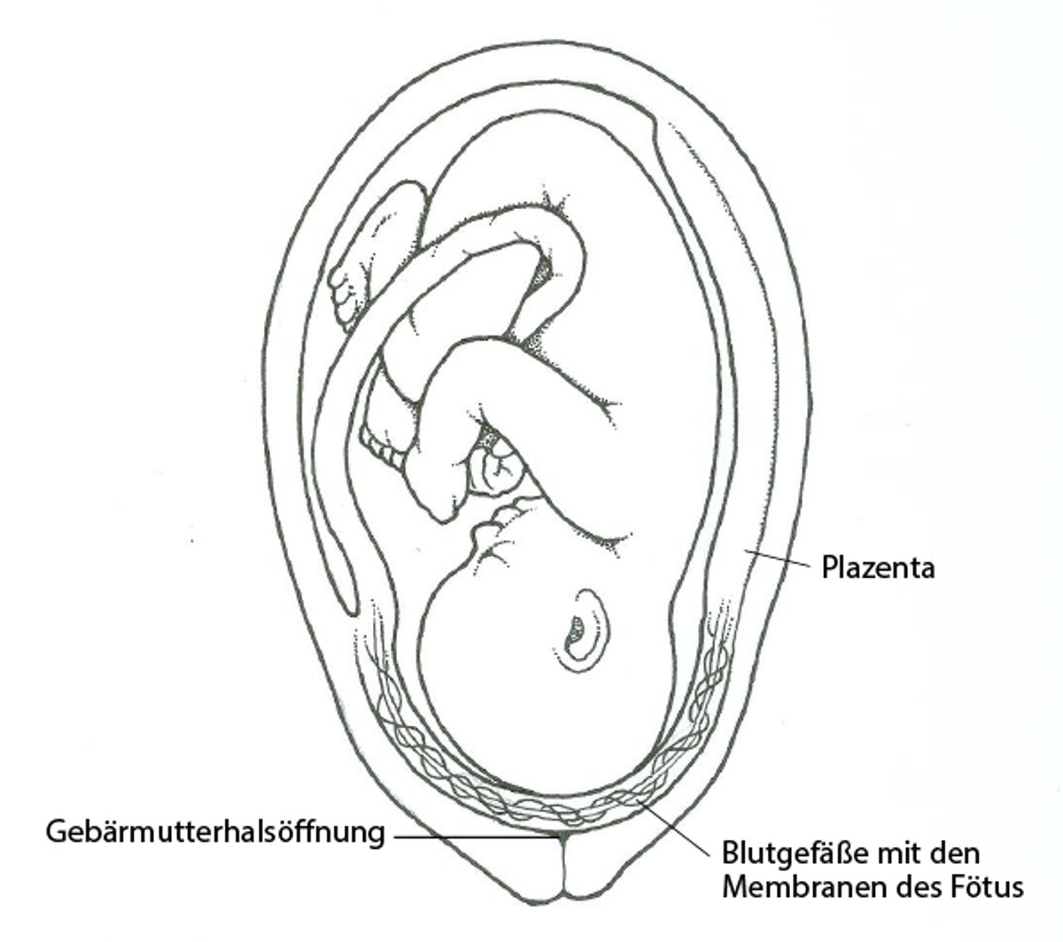 Was ist eine Vasa praevia?