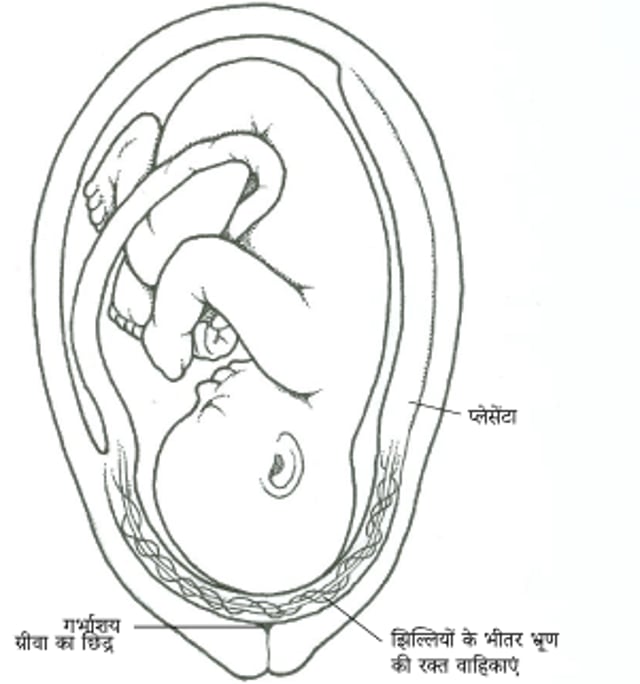 वासा प्रीविया क्या है?