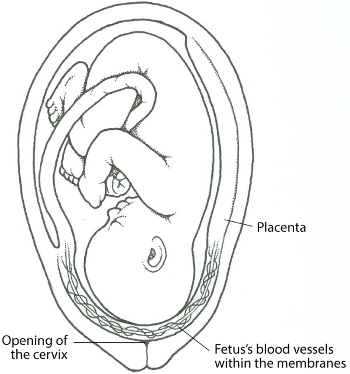Apa yang dimaksud dengan Vasa Previa?