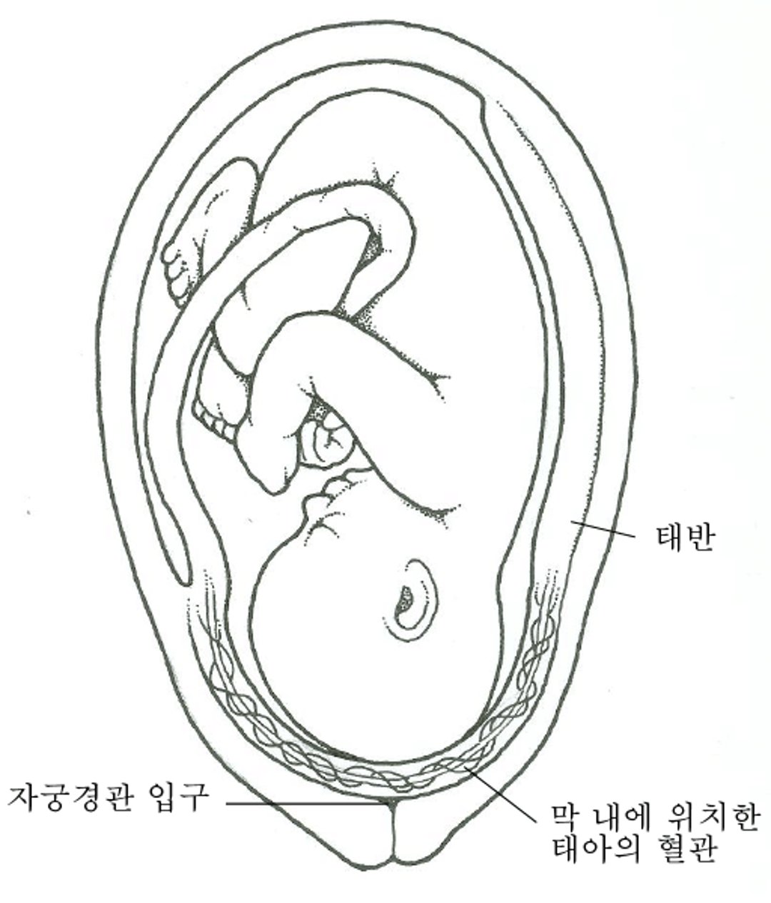 전치 맥관이란 무엇입니까?