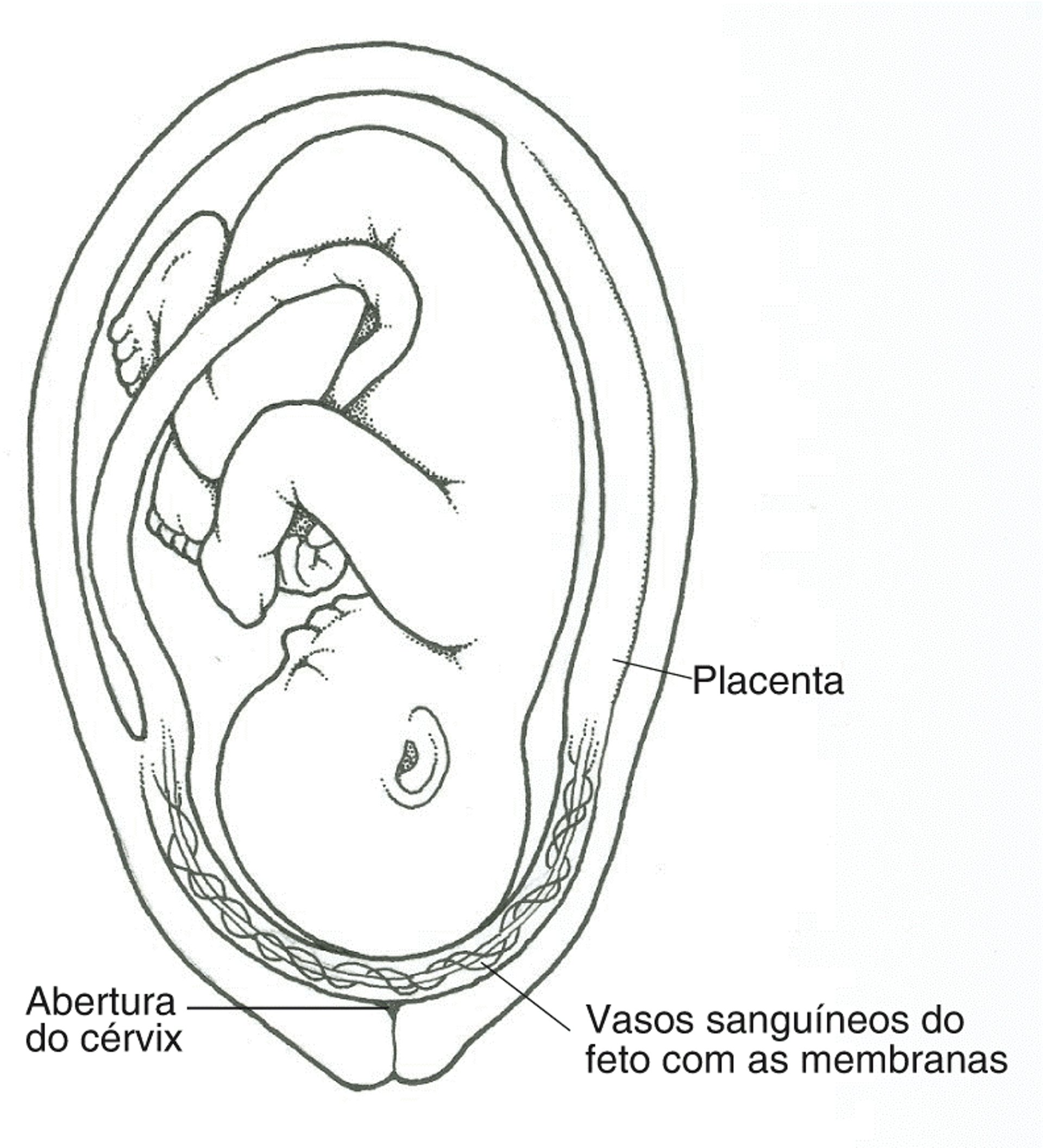 O que é vasa prévia?