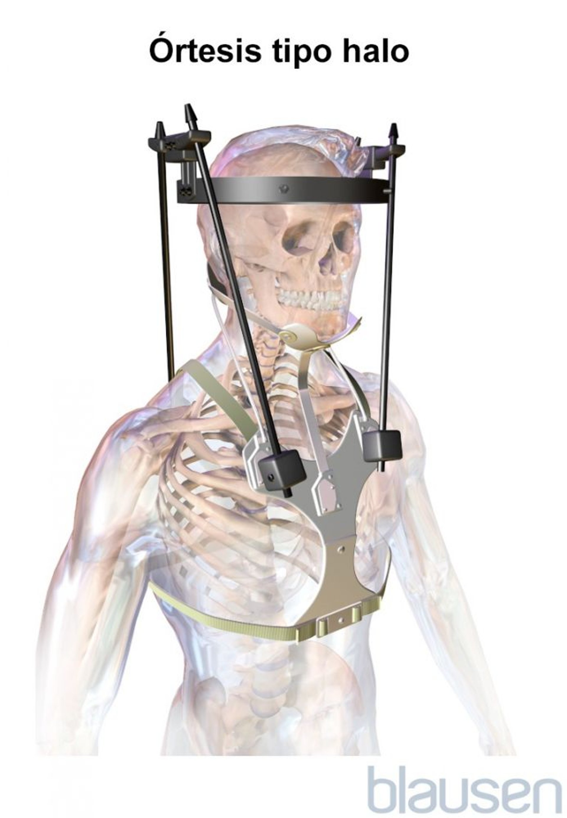 Halo cervical