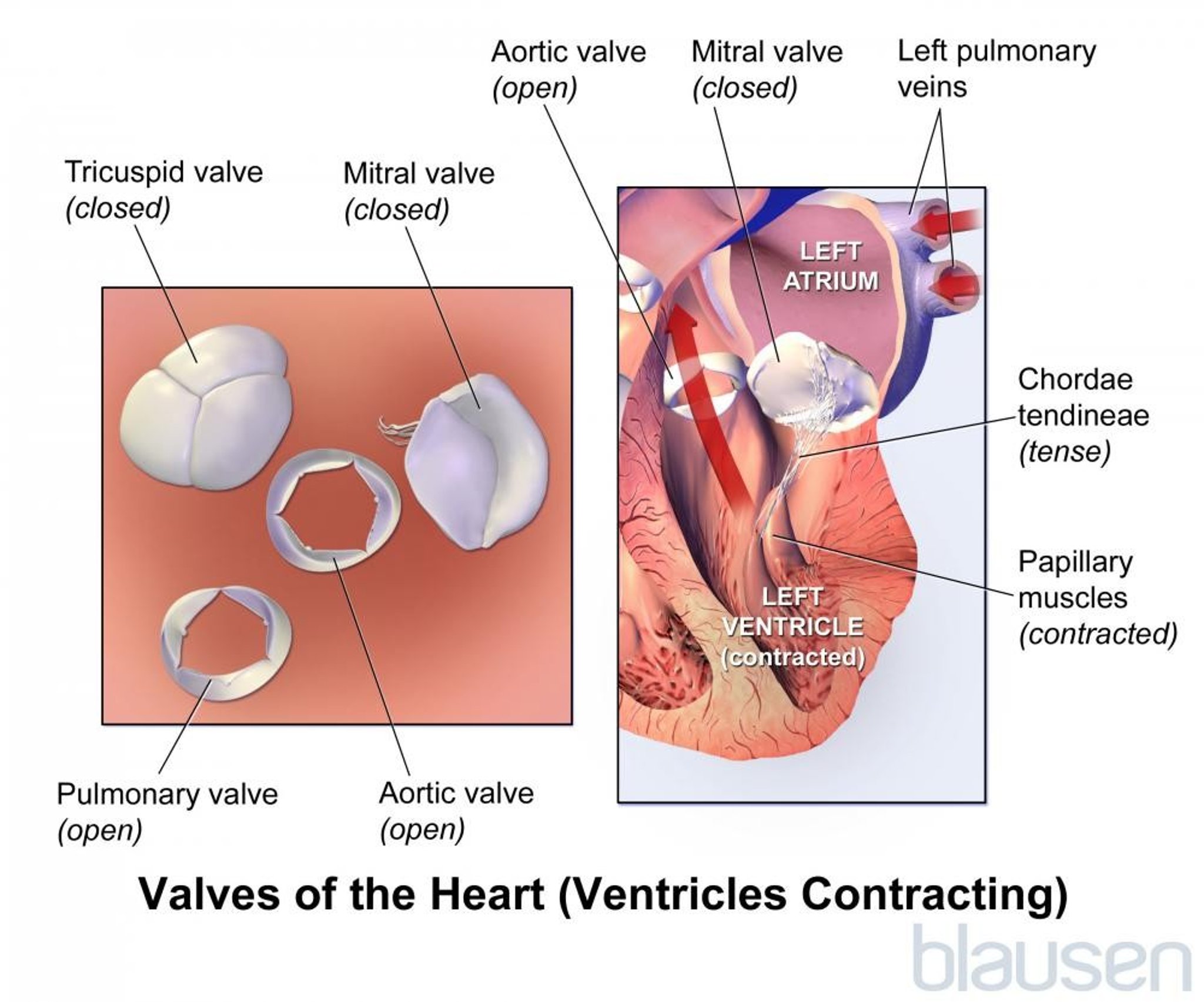 Valves of the Heart (Ventricles Contracting)