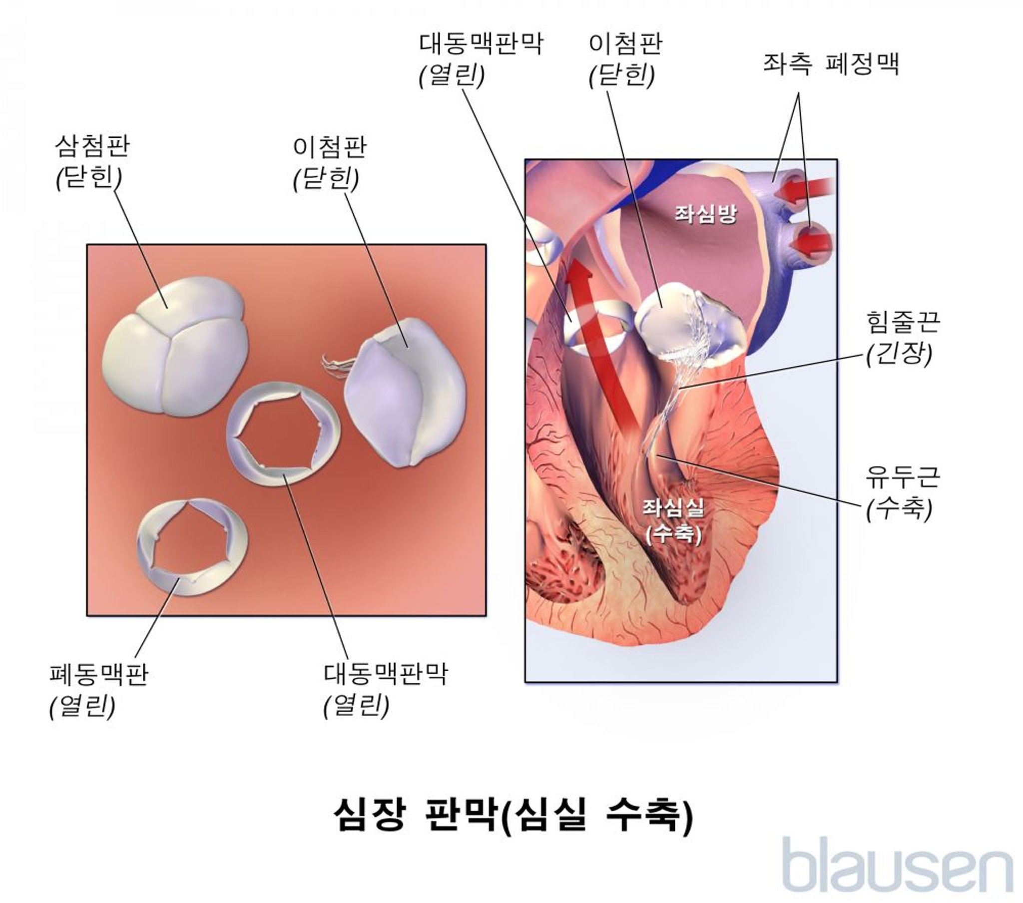 심장 판막(심실 수축)