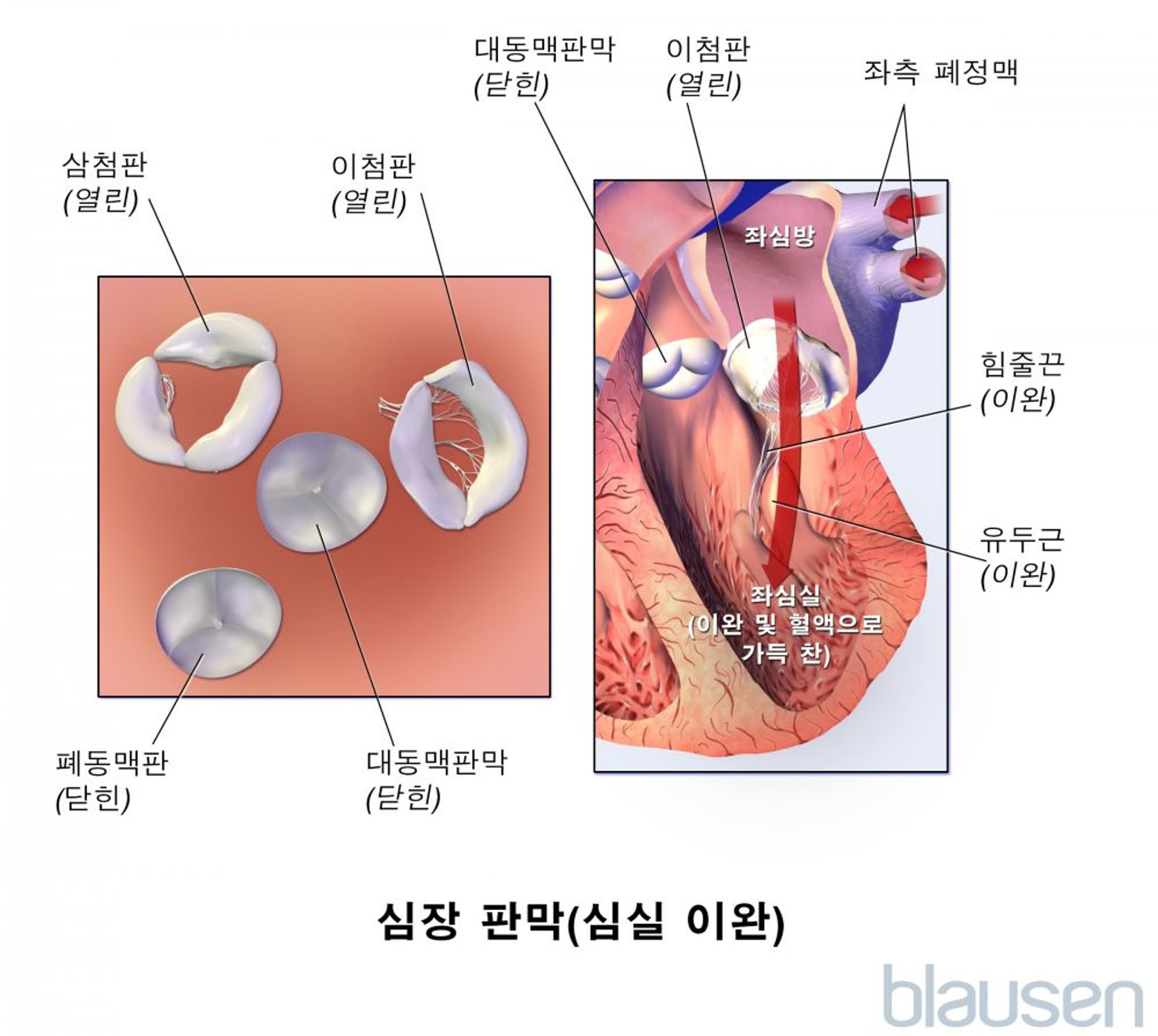 심장 판막(심실 이완)