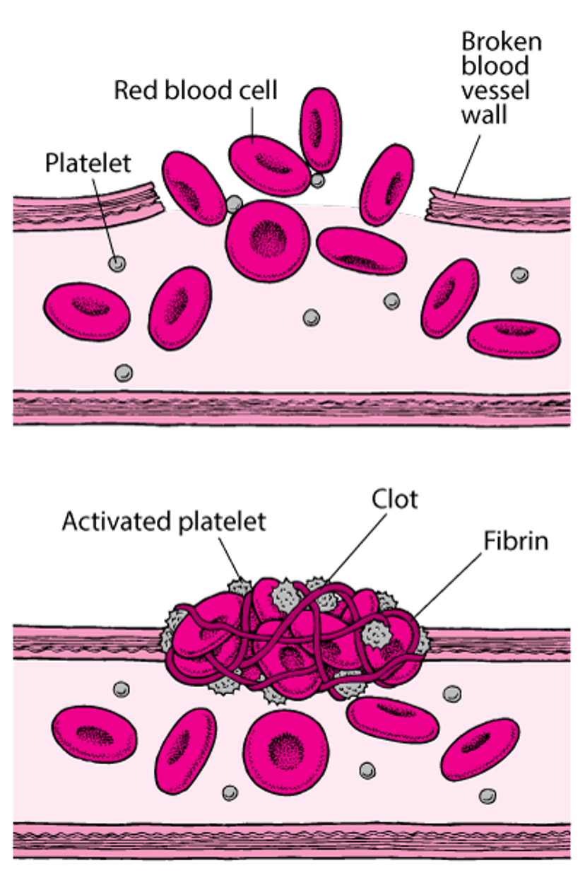 Blood Clots: Plugging the Breaks