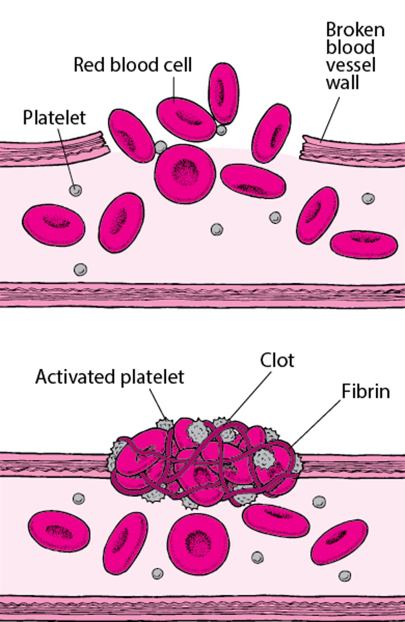 Blood Clots: Plugging the Breaks