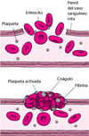 Coágulo sanguíneo: taponando las grietas