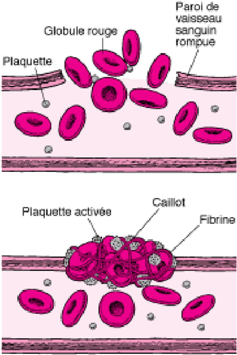 Les caillots sanguins : colmatage des plaies