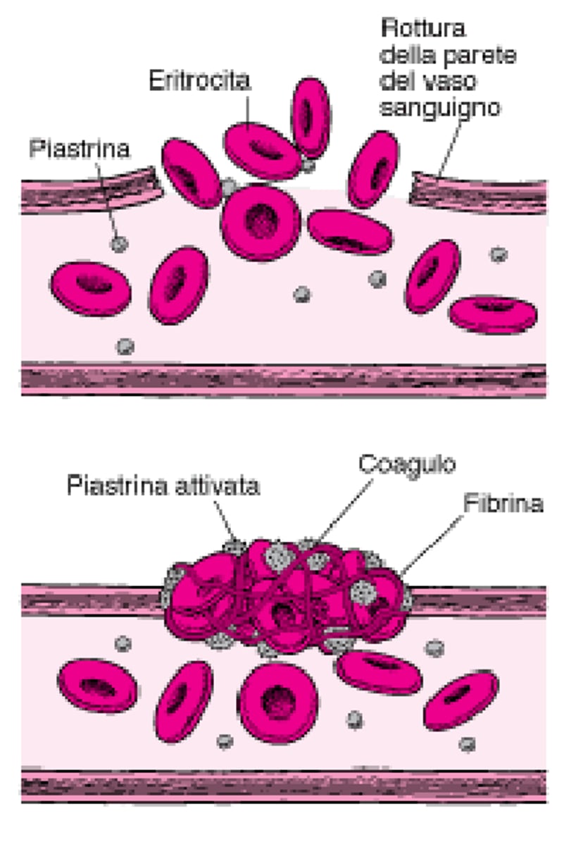 Coaguli di sangue: tamponare le perdite