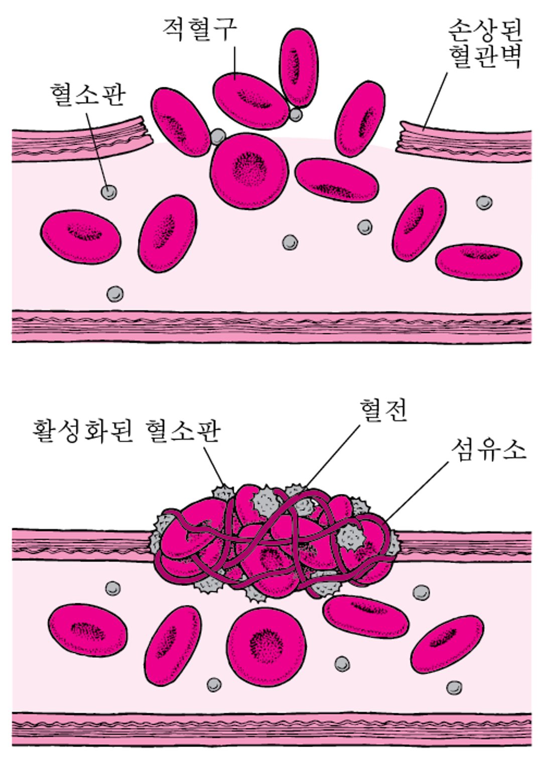 피떡: 파괴 부위 메우기