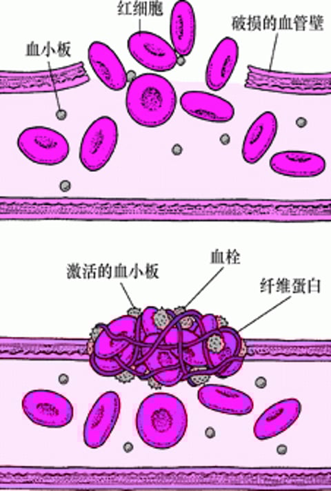 血凝块：堵塞破损部位