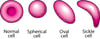 Red Blood Cell Shapes