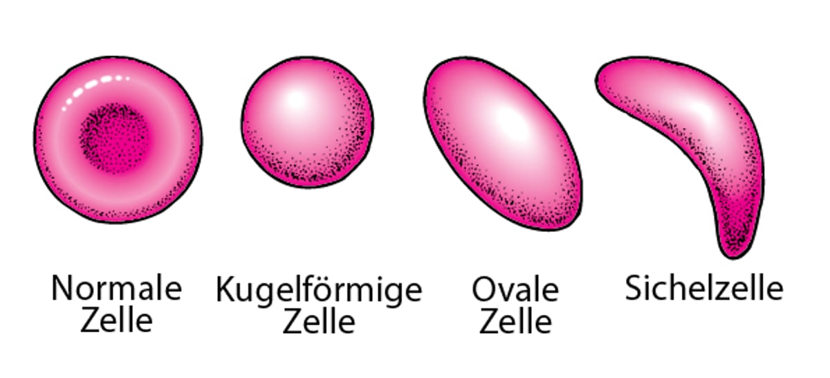 Formen von roten Blutkörperchen