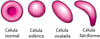 Formas de los glóbulos rojos