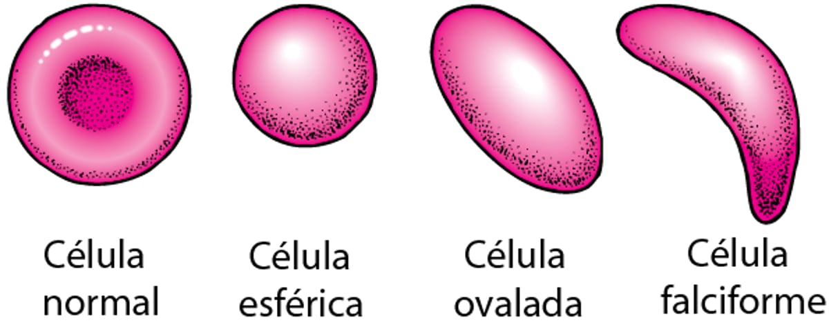 Formas de los glóbulos rojos