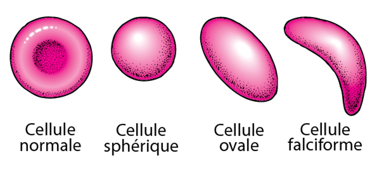 Forme des globules rouges