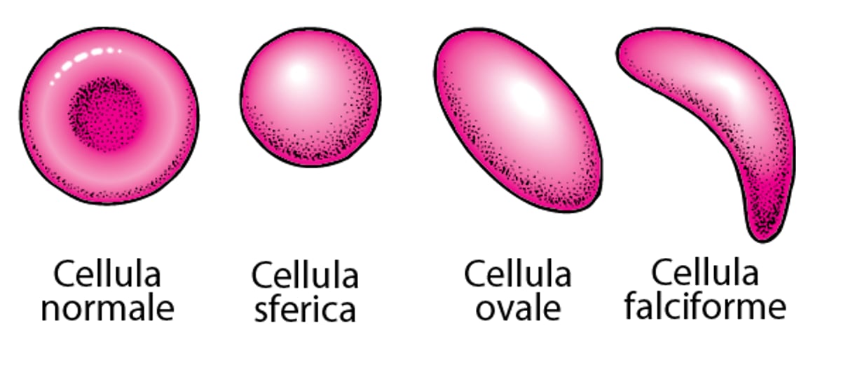 Morfologia dei globuli rossi
