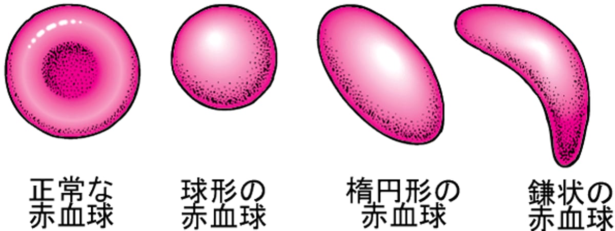 赤血球の形状
