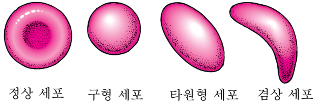 적혈구 모양