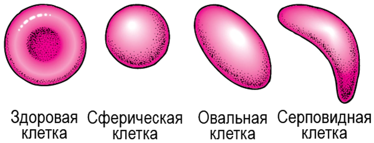 Формы эритроцитов