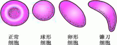 红细胞形态