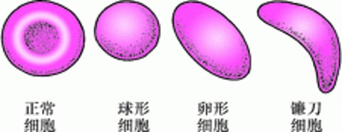 红细胞形态